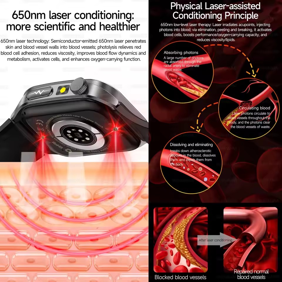 2026 Nieuwe Gezondheid Smart H - Industrial Laser Beam recensie en prijs